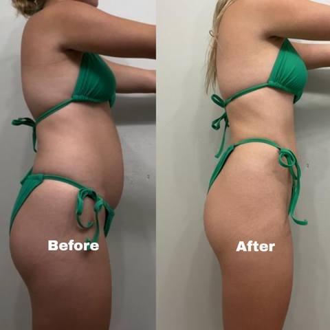 Client before and after