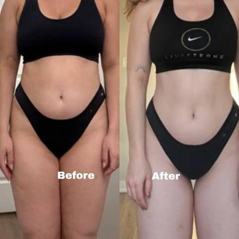 Client before and after